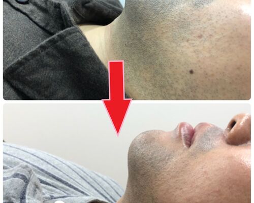 メンズサンプル